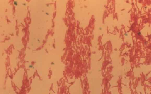 3�����ٲ���