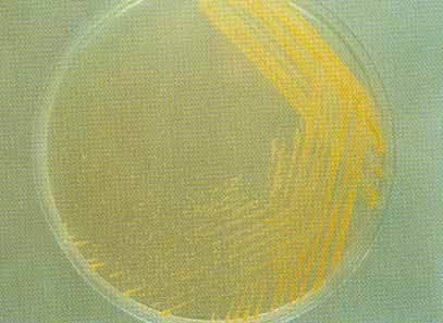 �����������������ͣ�