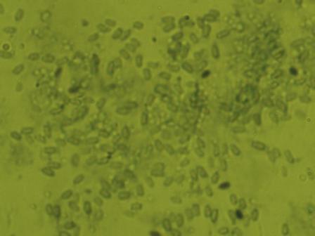 ���ȴ���˿��ĸ