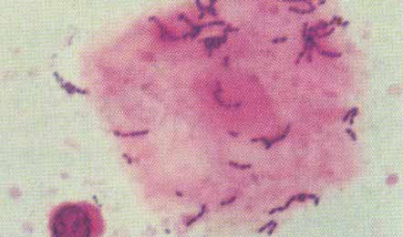 ����÷���ĸ