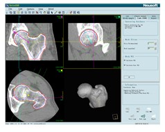 A���ܶȼ�����������ϵͳ