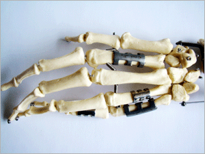 �ǿ�ָ�ƹǶ�