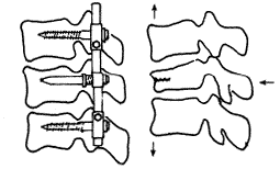 �ǿ�Dick׵�����̶���