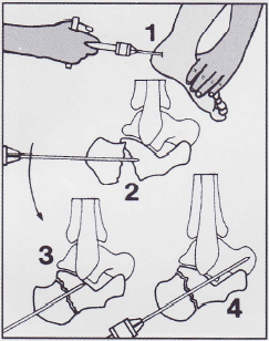 �ǿ�˹���루׶�����У�