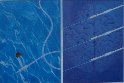 ����ƶ�ͯ�����ң���ǻ������