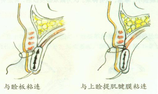 �ۿ�������