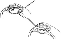 �ۿƽ�����