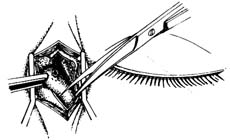 �ۿ�����ժ����