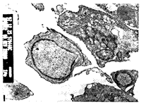 �˷ΰ�ϸ��NCI-H226