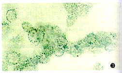 人骨髓横纹肌肉癌细胞RC13; RMS 13; SJRH30