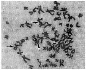 �˷ΰ�ϸ��NCI-H596