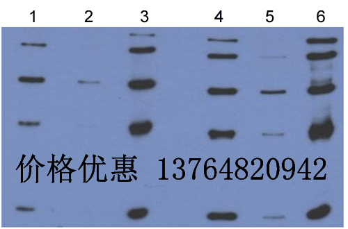ת���������ӨC������Anti-TGF-��