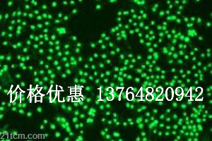 NKϸ��������Ȼɱ��ϸ��������忹��anti-NKG2D/CD134