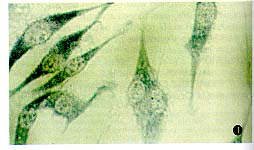 ����ĸϸ����D341 Med