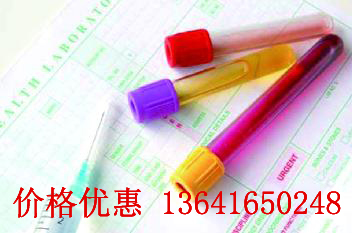 ӫ���ر�ǿ������Ǽ�ø����IgG