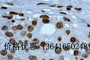 ӫ���ر��CXC��������16����IgG