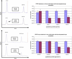 ���򿽱������죨CNV�����